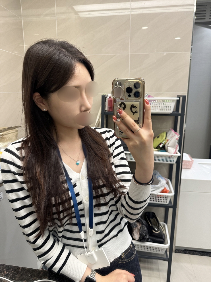 모르는 사람들이 보면 원래 코가 이쁜줄알정도로 자연스러운데 모양 진짜 마음에 들어요
