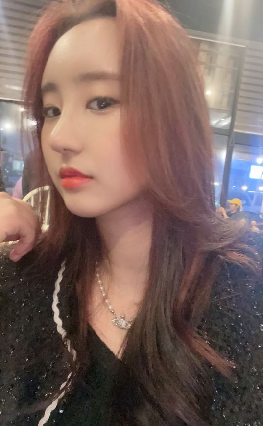 코, 이마지방이식 후기