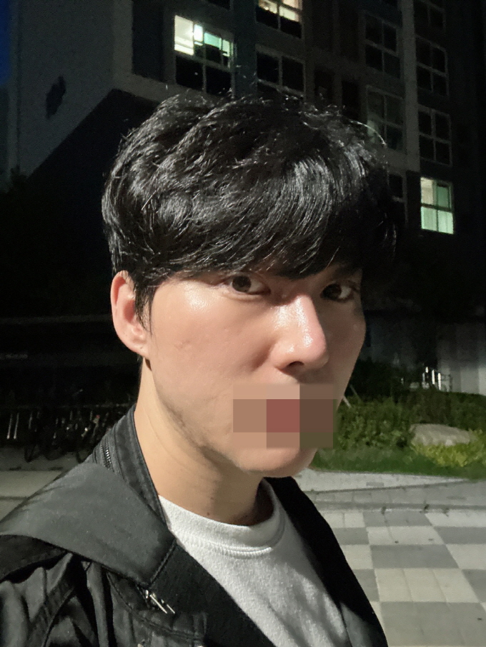원장님이 얼굴형에 맞게 잘 추천해 주셨어요