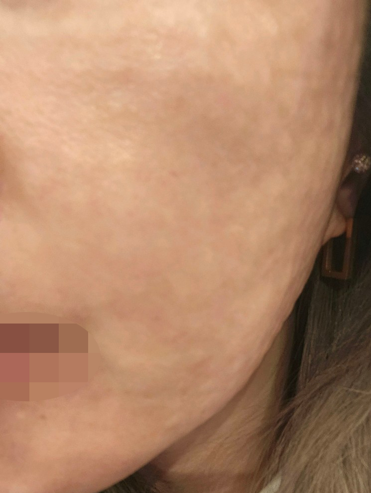 엠보 촘촘하게 잘 올라와서 다음에도 여기 오려고요!