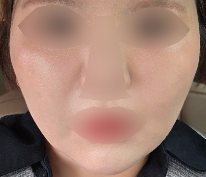 환절기 푸석함 때문에 왔는데 가격도 동일하고 빠르게 진행돼서 좋아요 ㅎㅎ