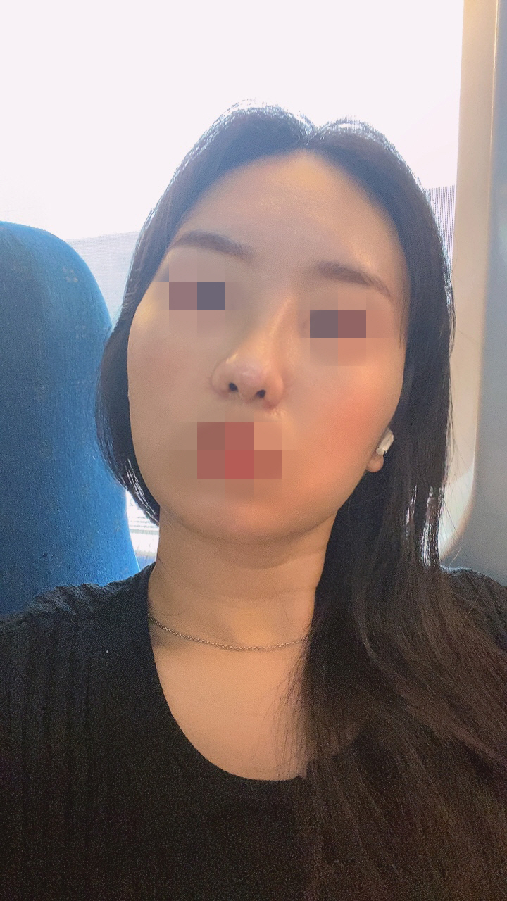 지금은 높아진 콧대에 자신감도 많이 생기네요!!