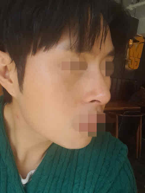 이제는 스스로도 적응하고 사진찍을때마다 전보다 잘나와서 좋습니다