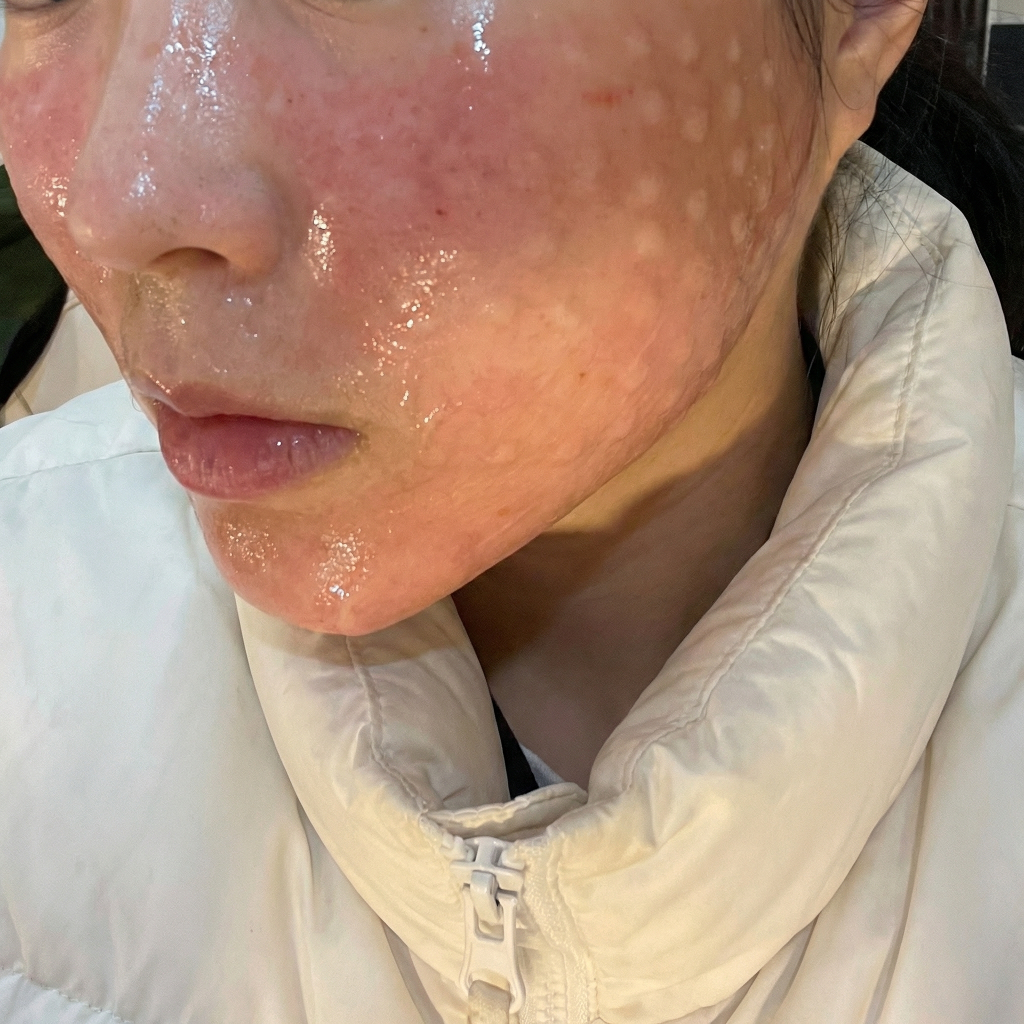평일 늦게까지 해서 좋아요~ 마취 덕에 고통 없이 받았어요!