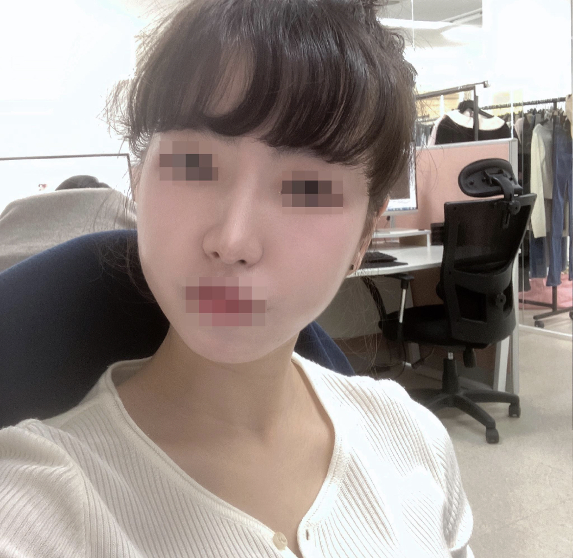 서울아이 성형외과 열심히 찾은 보람이 있었어요