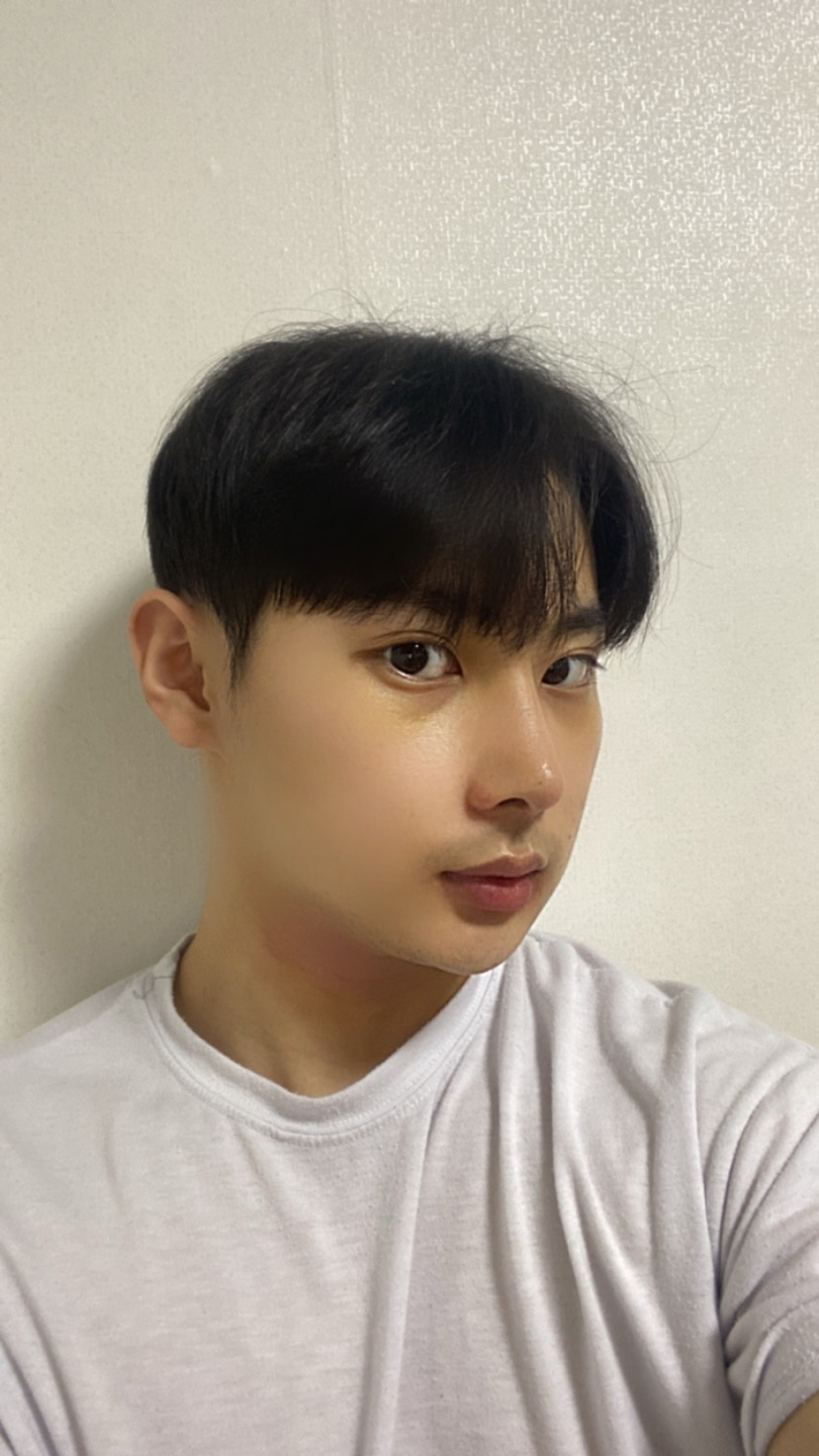 상담때도 너무 친절하셨고 수술결과도 너무 만족합니다