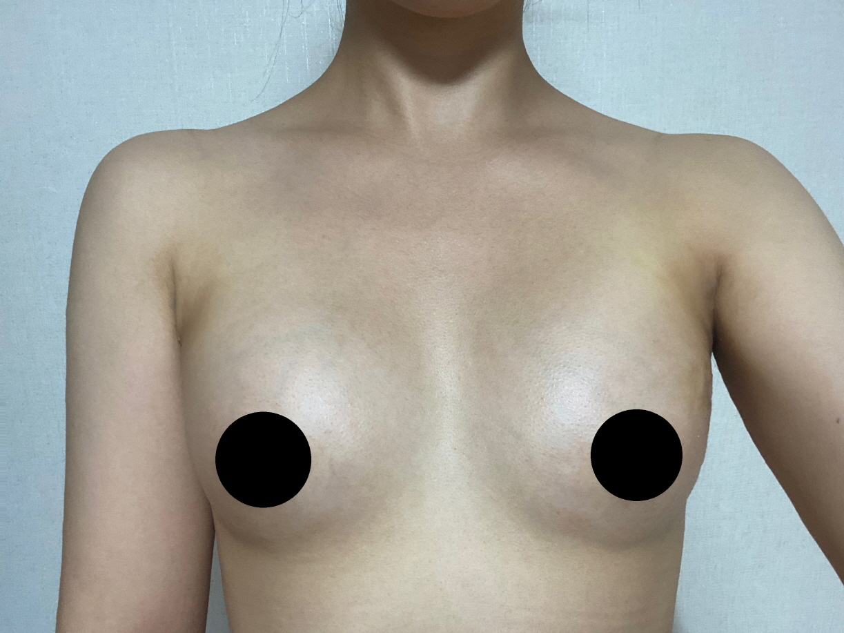 모양도 크기도 자연스럽고 예쁘게 잡아주셔서 너무 만족입니다!