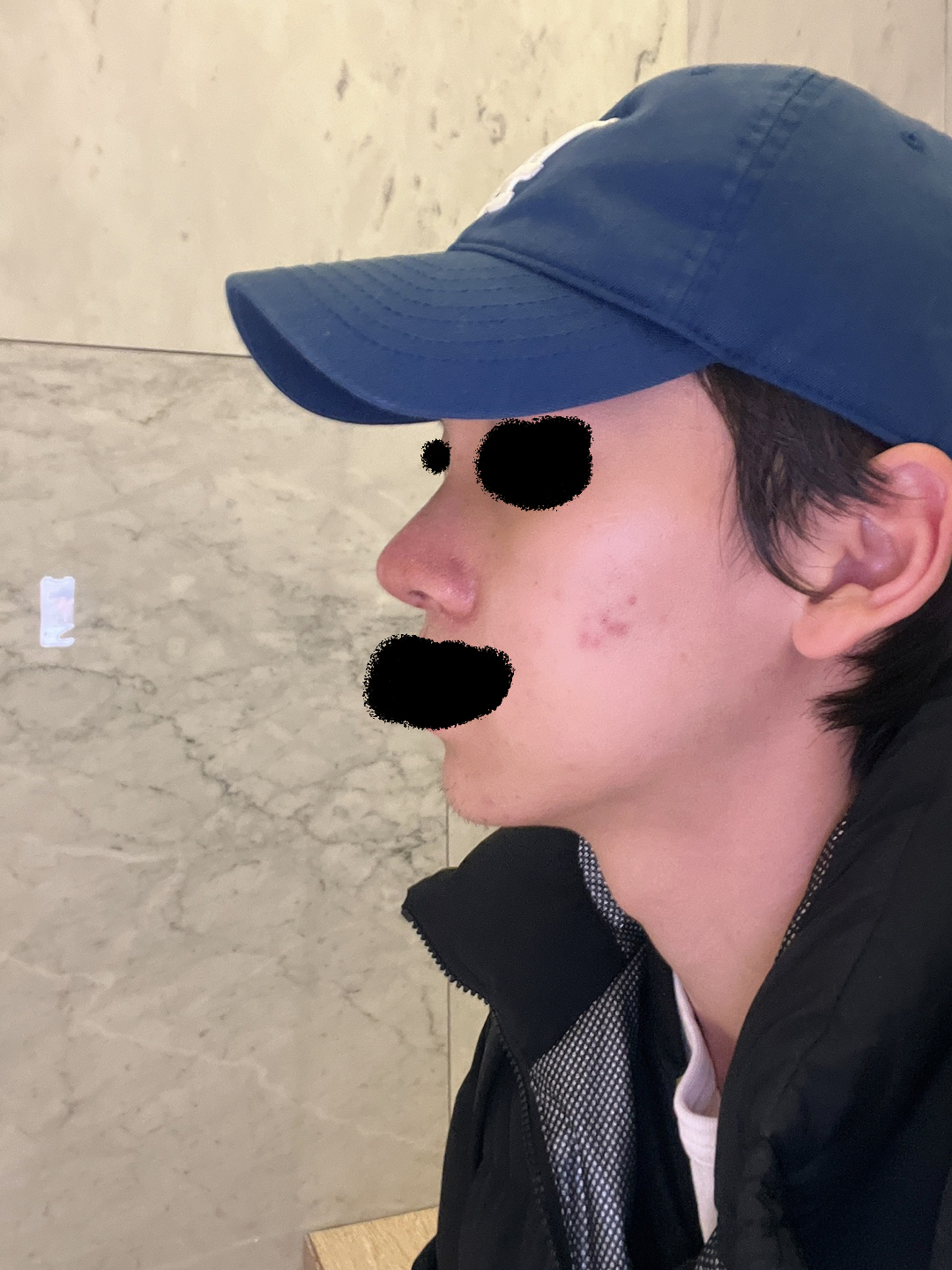 사진은 7일차입니다.