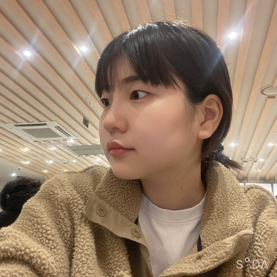 수술 후 아직 붓기가 다 빠지지 않았음에도 벌써 만족스럽습니다 !