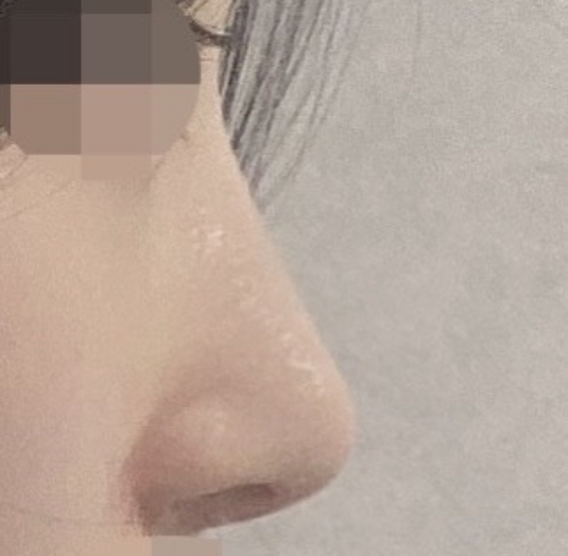 지인추천으로 여기서 상담받아보게 되었고 다 친절하셔서 좋았고 과잉진료 없었어요~