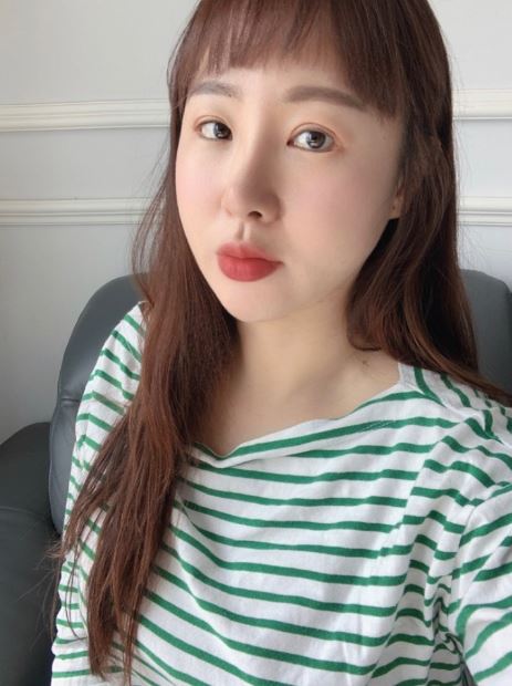 서울아이 지방흡입 강추!