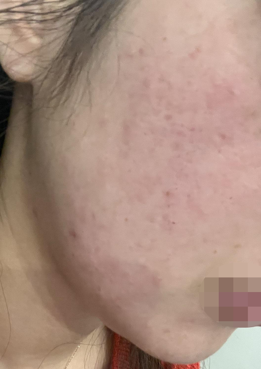 써마지 받아봤는데 빠른 응대에 친절한 직원분들까지 만족이에요~