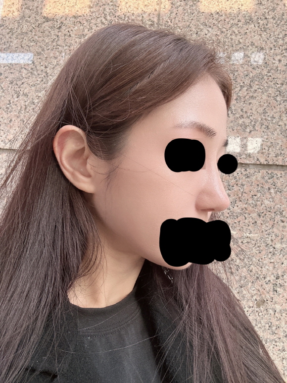 고민하지 마시고 서울아이에서 수술하세용!!