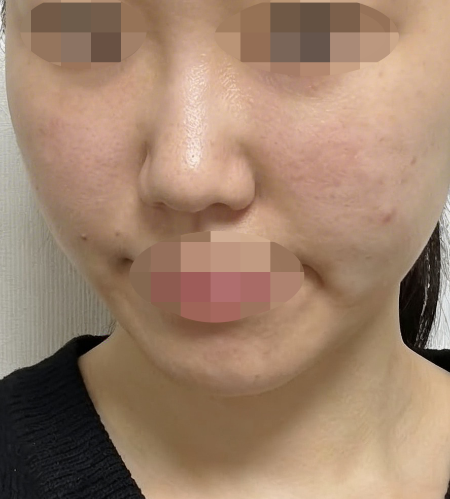쥬베룩이랑 온다 같이 받았는데 라인 정리 효과 바로 나타나요 ㅎㅎ