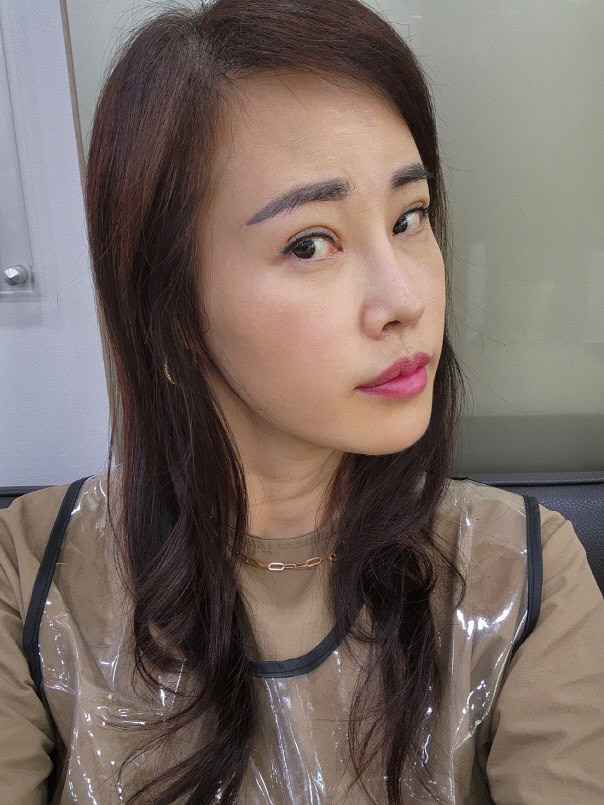 과하지 않게 수술도 예쁘게 되었어요