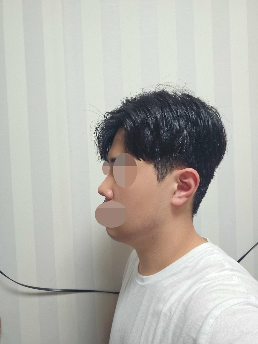부작용 하나없이 숨도 정말 편하게 잘 쉬고 있습니다 ㅎㅎ