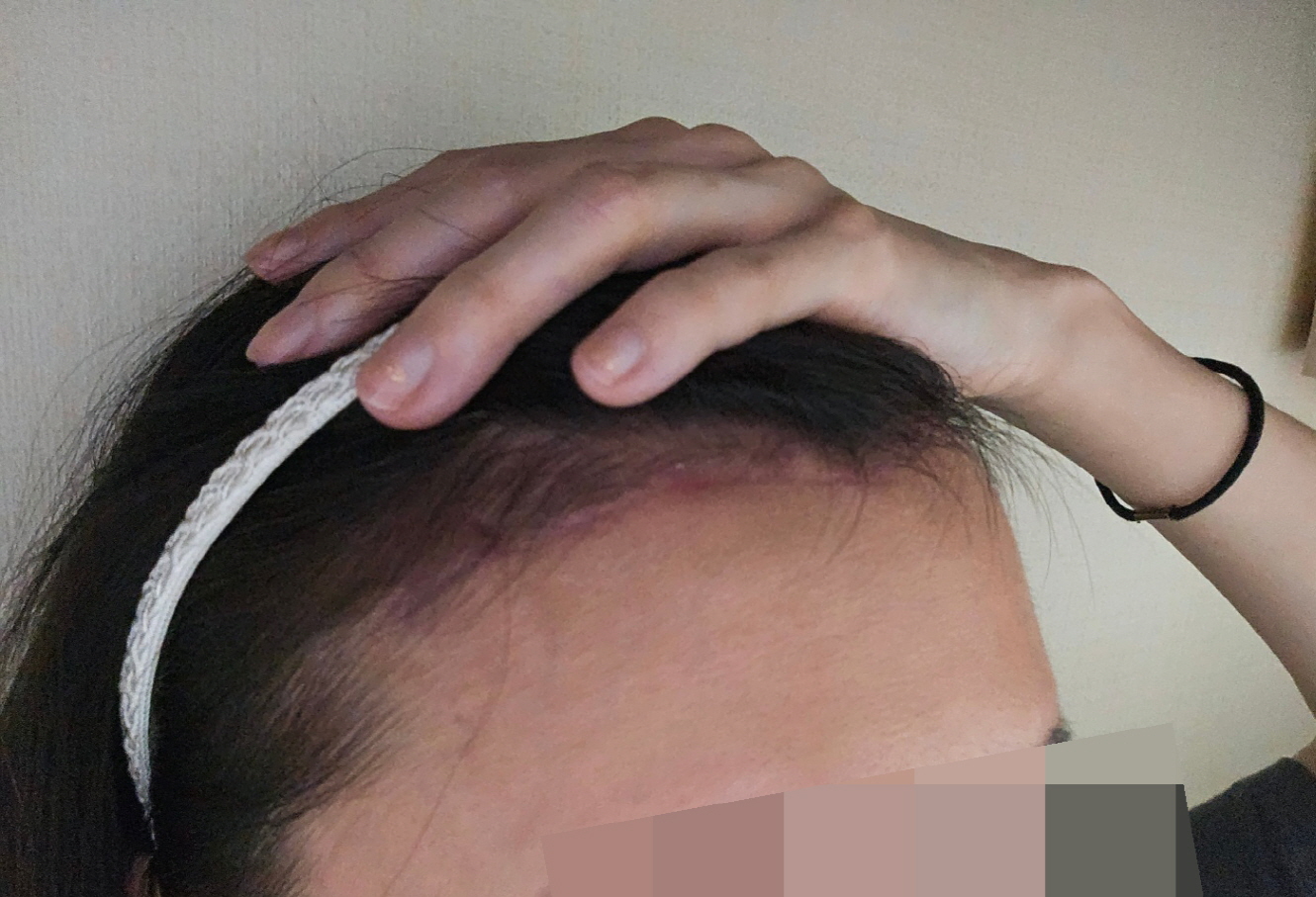 긴 고민 끝에 했지만, 후회 없는 선택이었습니다.
