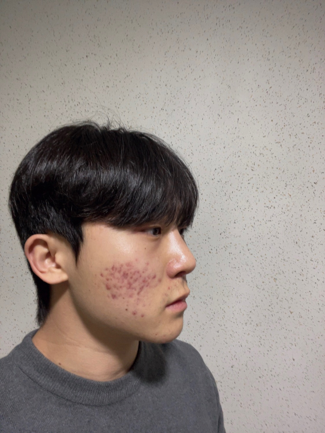 코붓기도 많이 빠지고 전체적으로 마음에 들어요