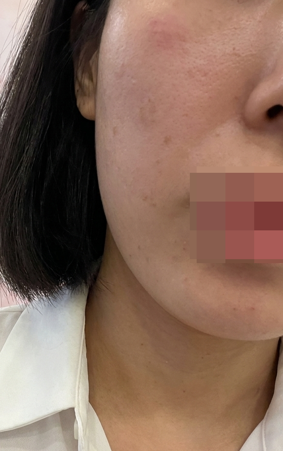 일상 복귀 빠른 쥬베룩, 꾸준히 받기로 결심했어요