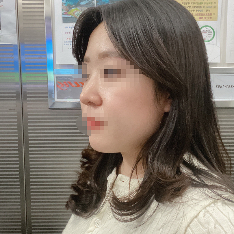 마지막으로 황원장님 뵙고 왔을때도 잘 됐다고 해주셔서 더 안심이 됩니다~