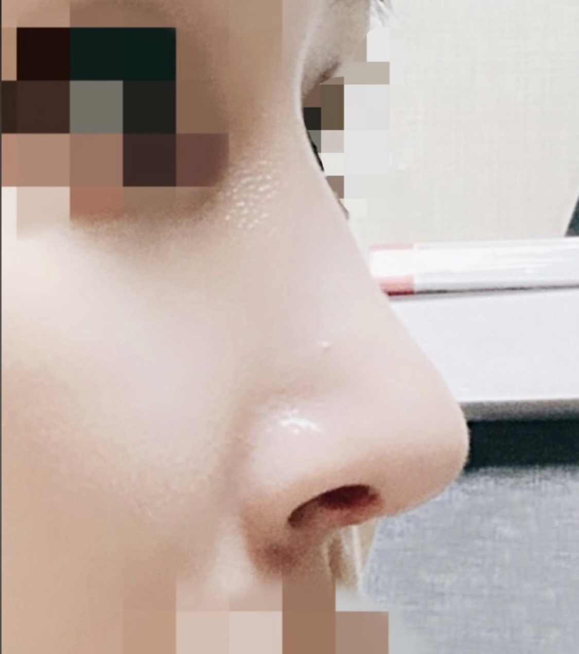 코끝까지 묻고 더블로ㅋㅋㅋ