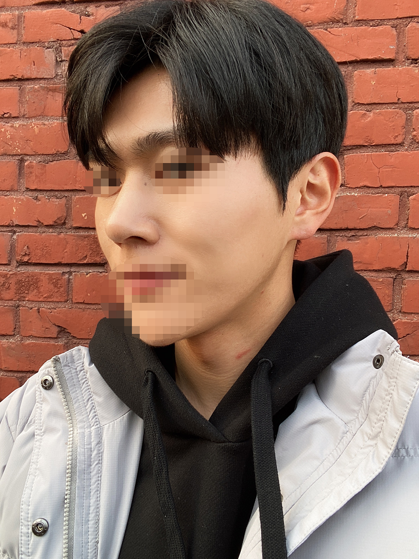 점점 더 자연스러워져서 이전의 얼굴을 잊은 듯 살고 있습니다.