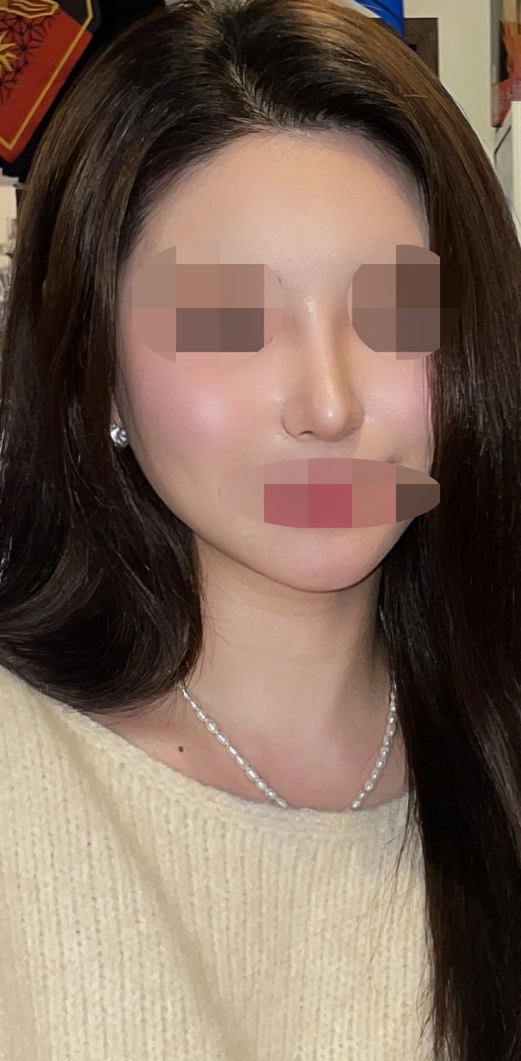 다시는 재수술할 일 없을 거 같아요!