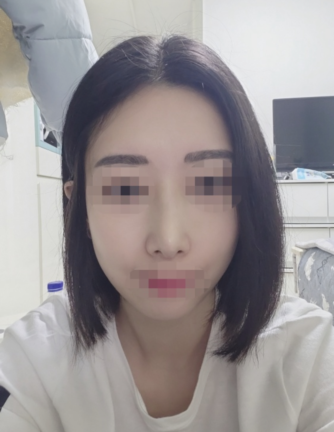 부목을 떼고나니 훨씬 숨쉬기 편해졌어요