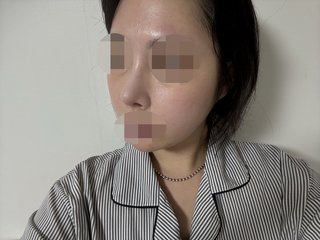 처음에 비해 많이 자연스러워졌고 이제 이물감 안 들어요 ㅎㅅㅎ!