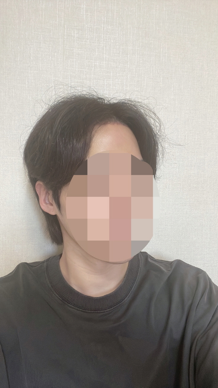 이마 이쁘게 돼서 너무 좋아요 감사해요