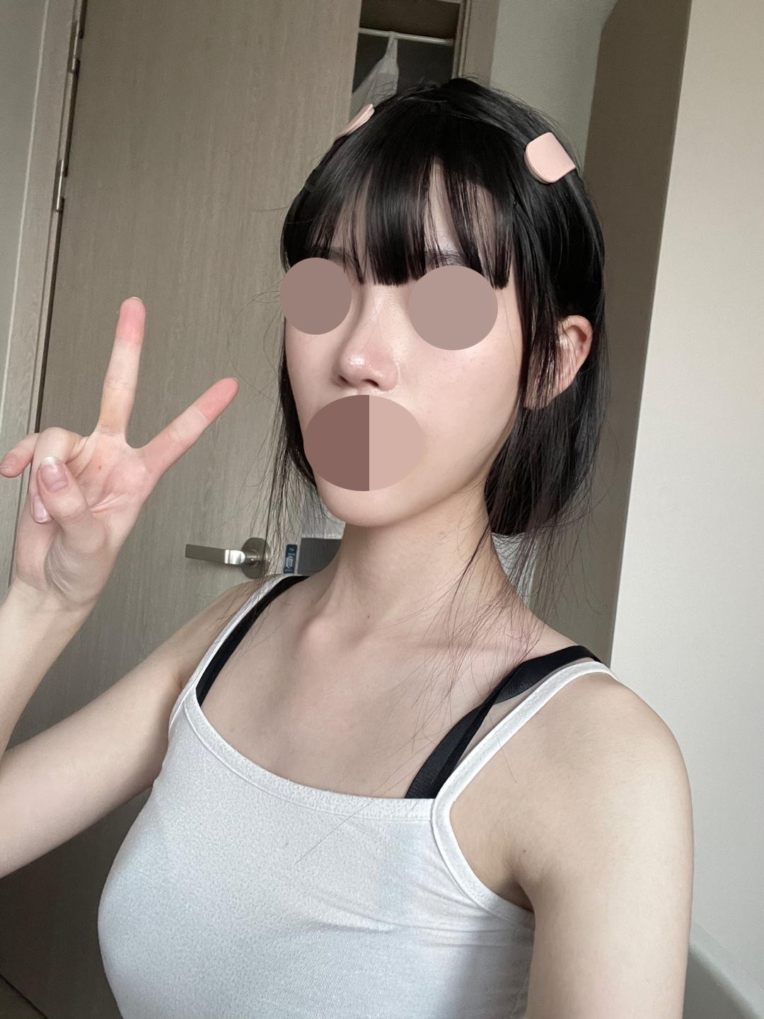 원장님이 꼼꼼하게 봐주셔서 좋았어요