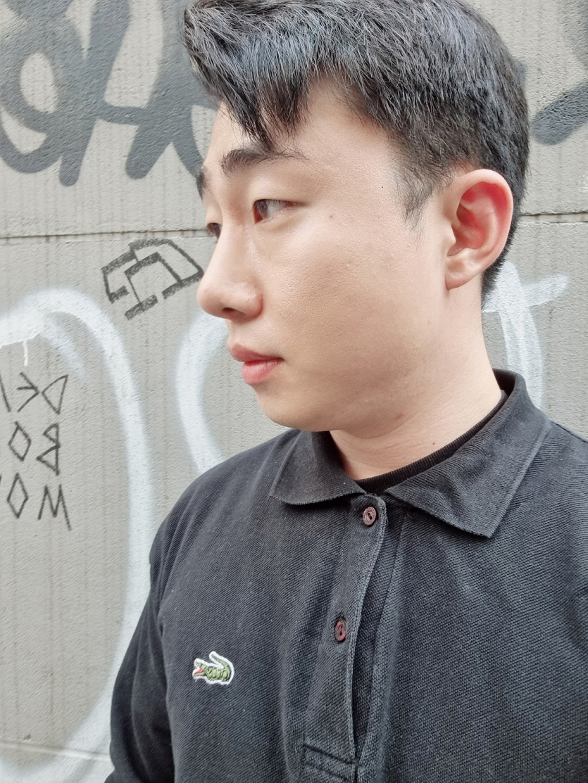 서울아이성형외과에서 코 수술 후 2달 되었습니다.