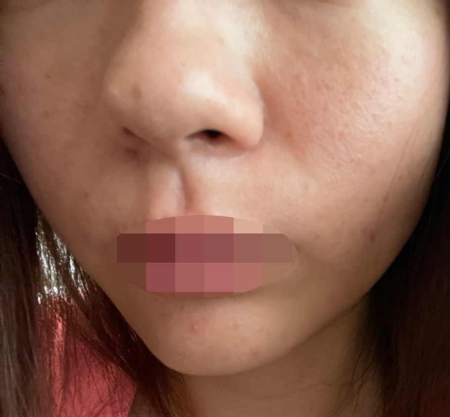 일본어 직원분 덕분에 리쥬란,쥬베룩 편하게 받아봤어요~