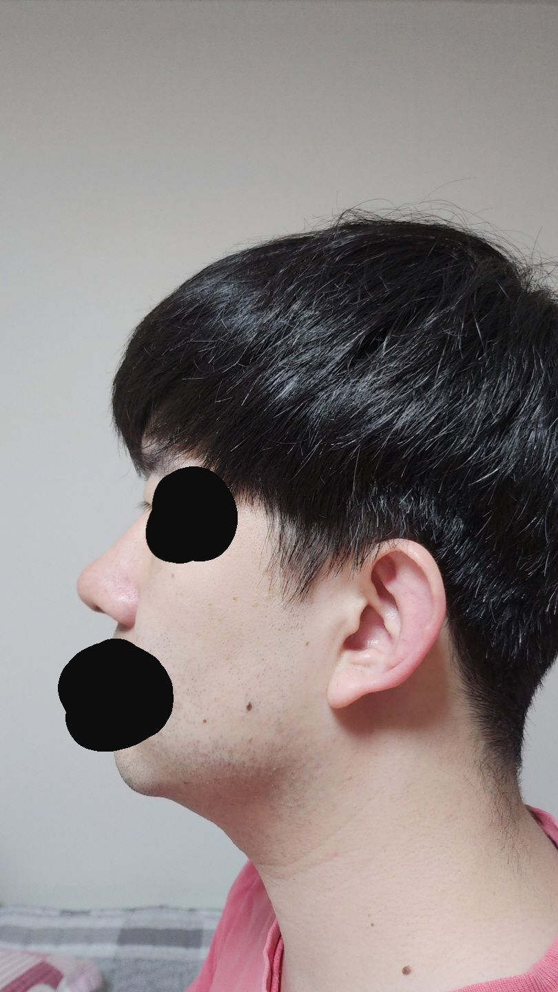 합리적인 가격에 만족스러운 코수술을 원하시는 분들에게 추천합니다.