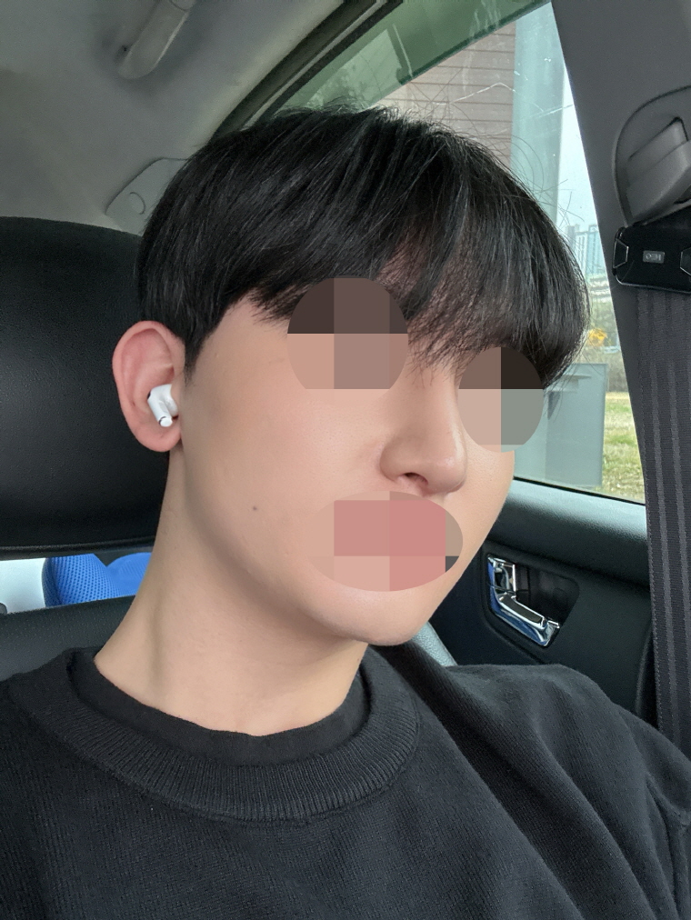 깔끔한 병원에서 친절한 직원분들 덕분에 수술 잘된 뒤에도 꾸준히 기분좋게 다녔습니다!