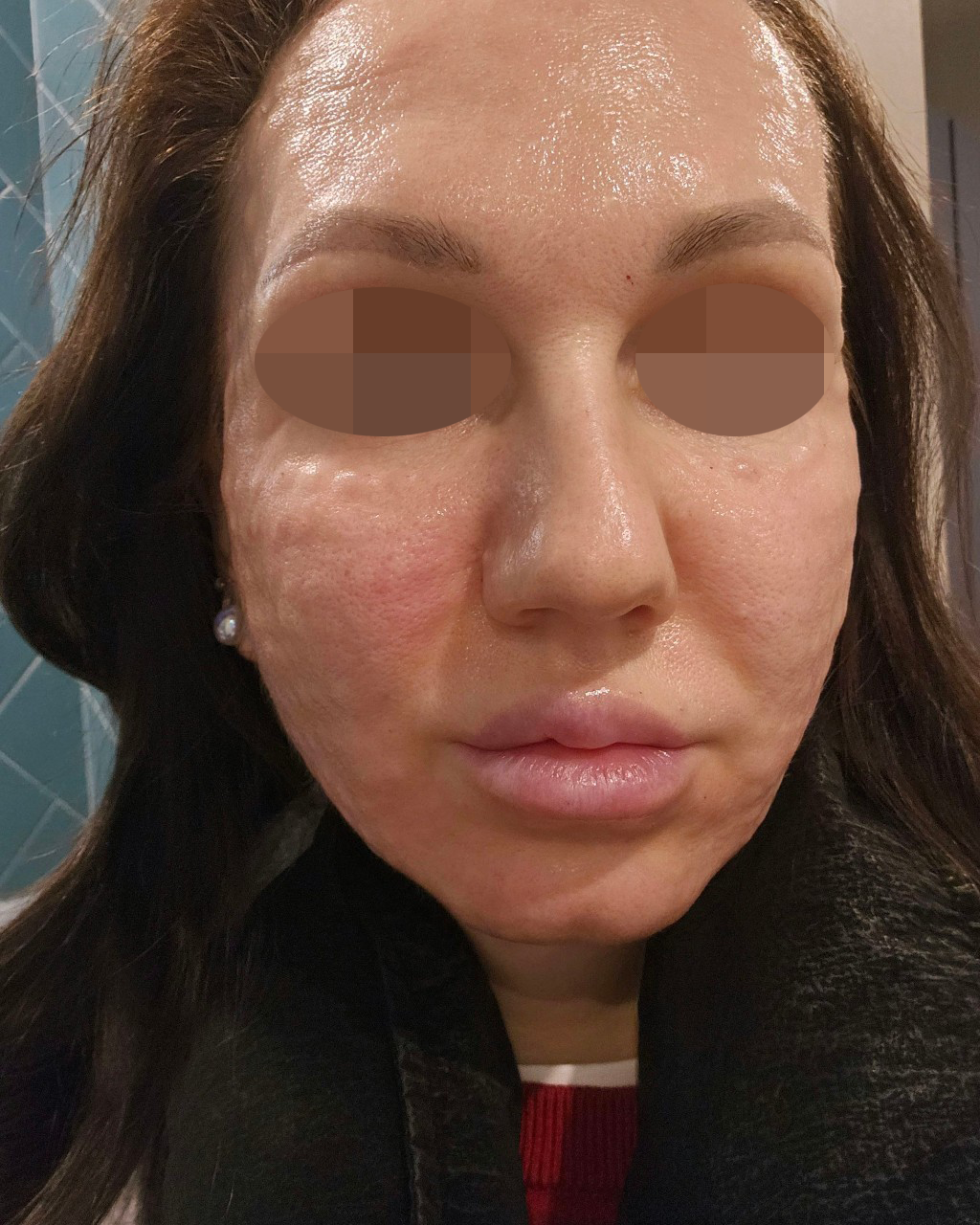 15분도 안 걸리고 통증도 없어서 너무 간편했어요~ 친구들한테 추천할게요!