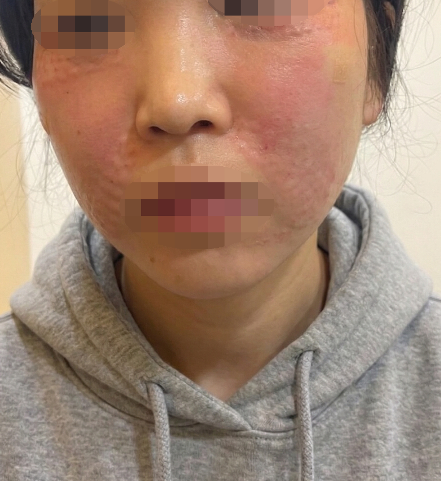 리쥬베룩 받았는데 화장 안 뜨고 건조함도 잡힌 것 같아요 ㅎㅎ