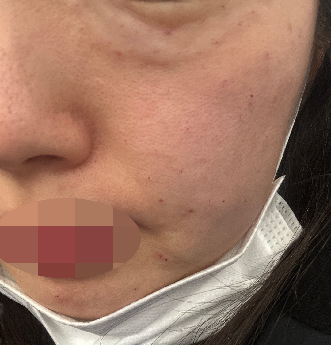 쥬베룩 받았는데 직원분들 친절해서 또 올 것 같아요 ㅎㅎ