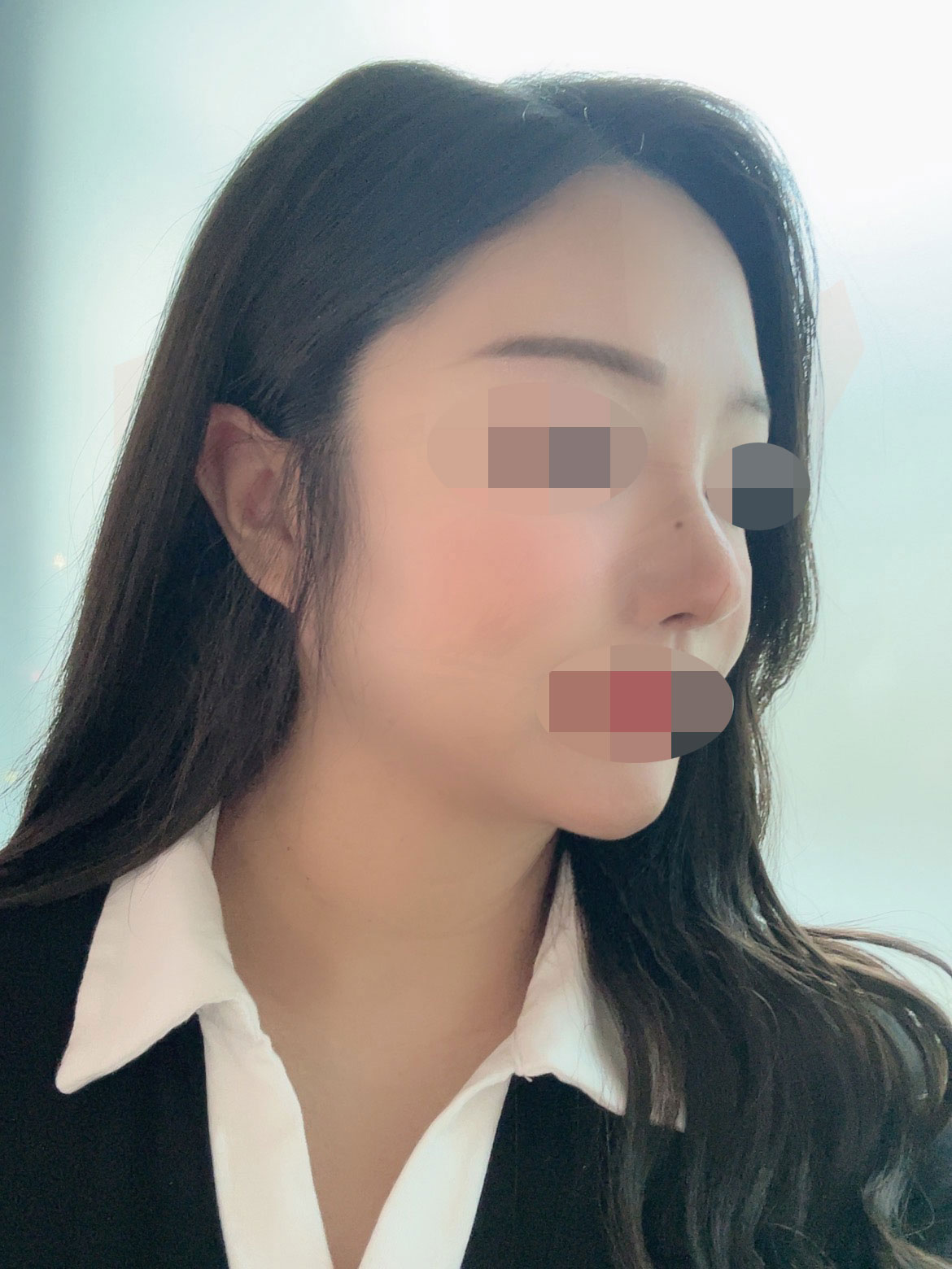 부작용 하나 없이 자리잡아서 너무 행복합니다
