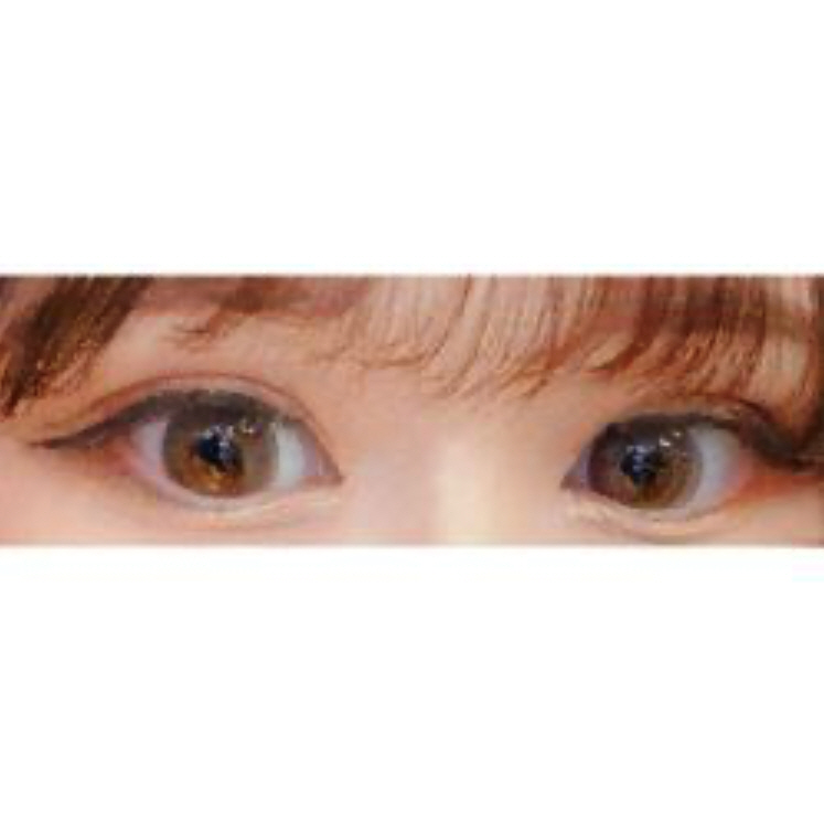 윗트임 쌍수 후기요