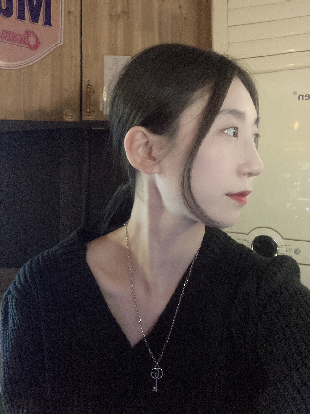 매부리 수술하고 많이 좋아졌어요!