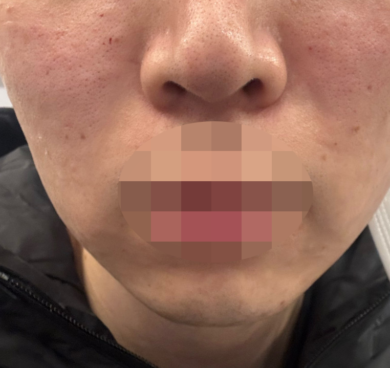 예약시간 맞춰 안내해주시고 필요한 시술만 상담해줘서 좋았어요!