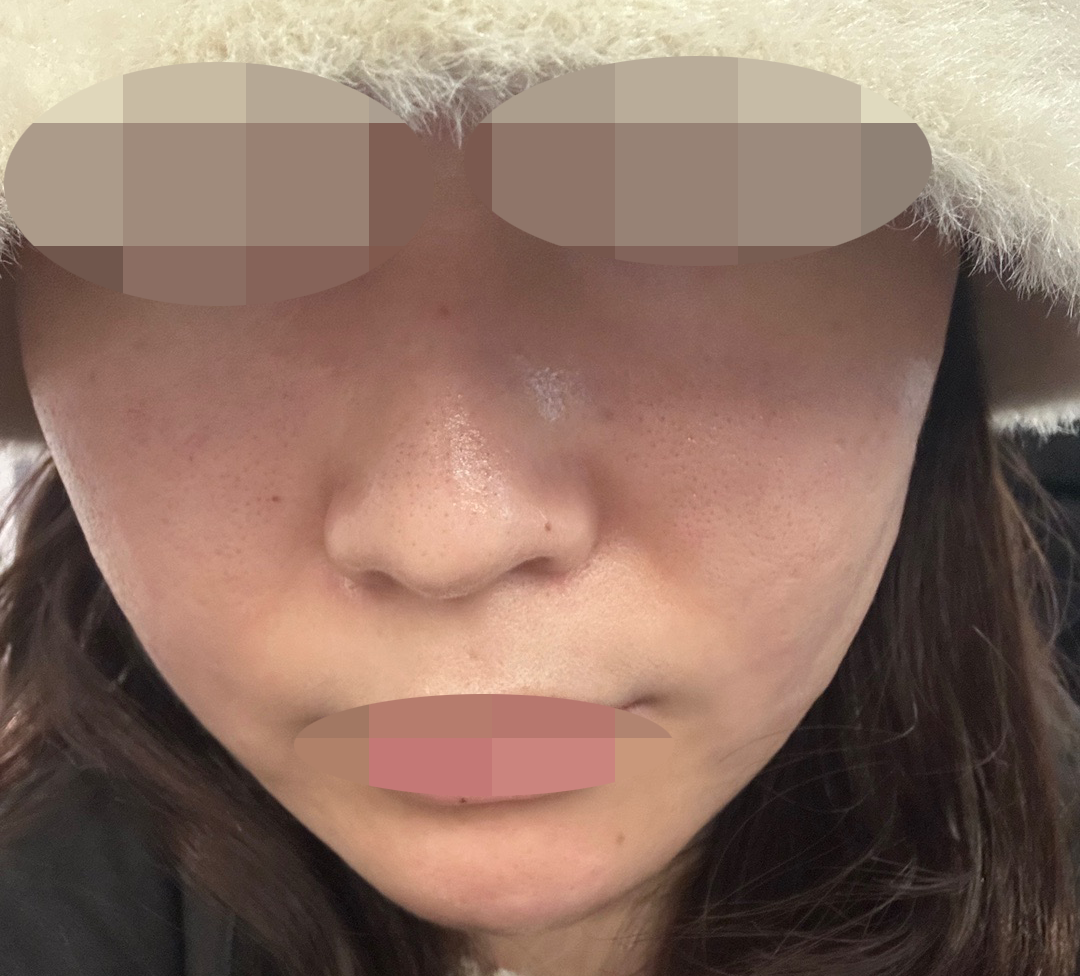 대기 짧고 끝나고 팩까지 해줘서 만족이에요~!