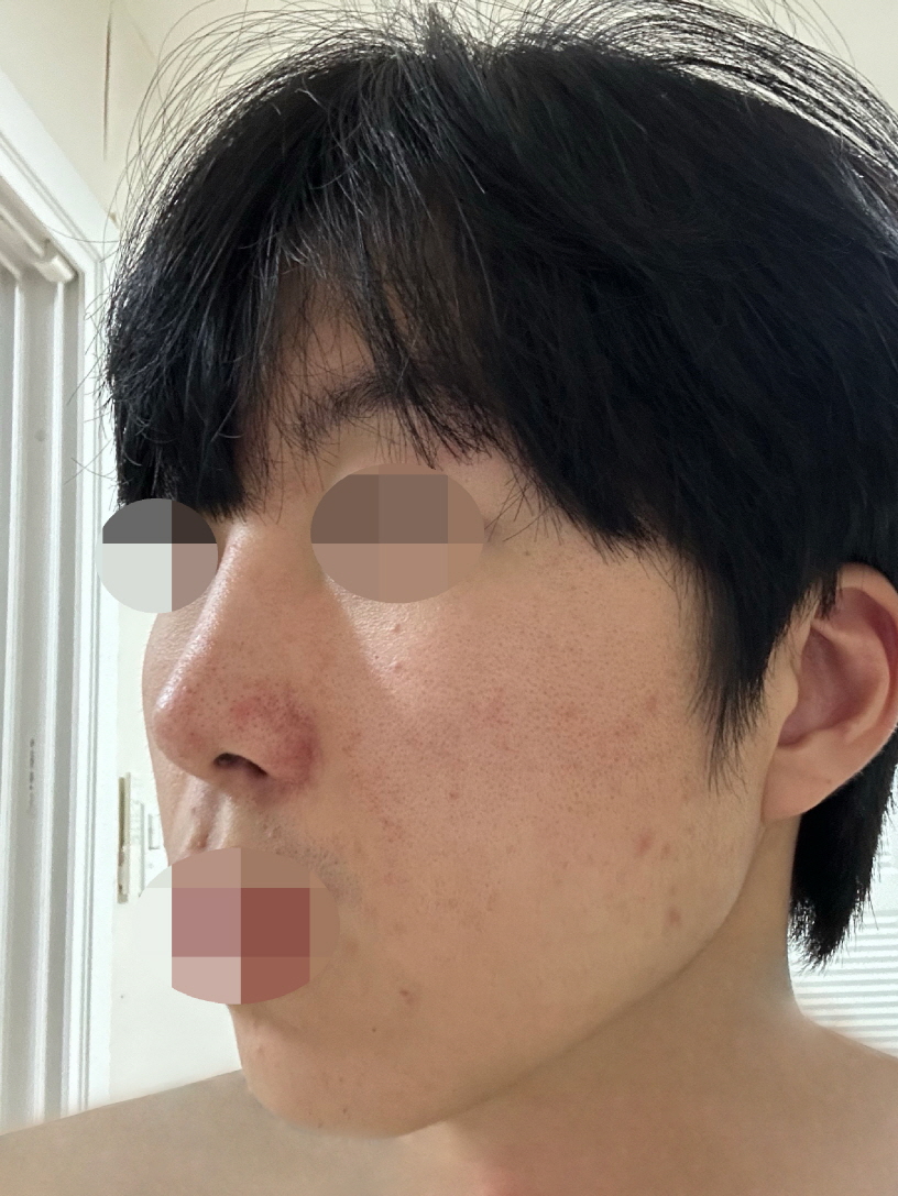 믿음으로 선택했는데 너무 잘 회복하고 만족하며 지내고 있습니다