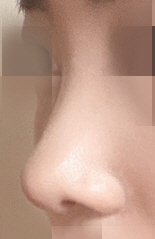과하지 않게 해달라고했는데 정말 자연스럽게 됐고 솜넣고있을때만 힘들고 하나도 안아파요!