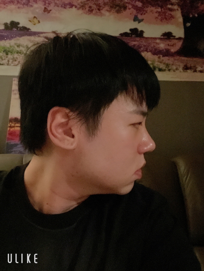 아픈건 1도 없고 부작용도 없이 잘 지내고 있어서 너무 좋네여