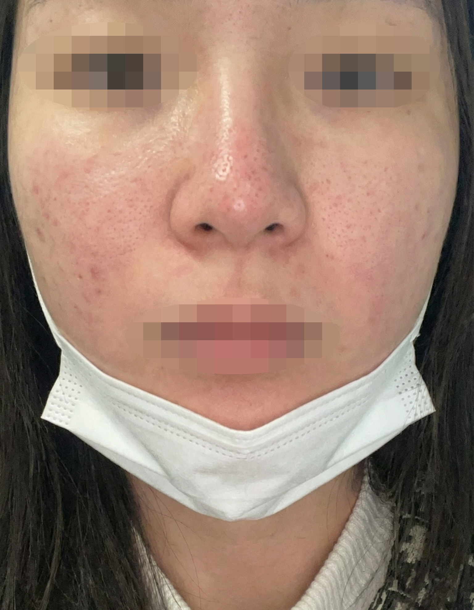 건조해서 리쥬란 받았는데 직원분들 친절하고 대기도 짧아서 좋았어요 ㅎㅎ