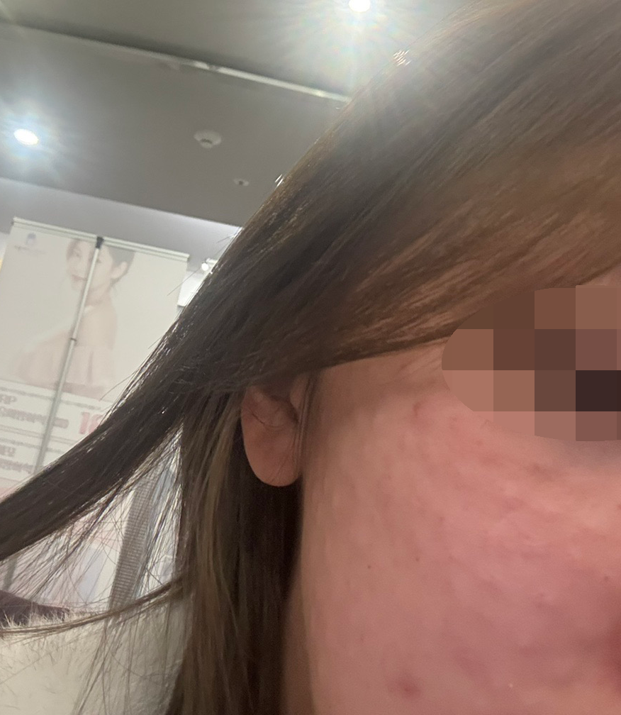 전에는 엠보 없었는데 여긴 짱짱해서 좋은 것 같아요 ㅎㅎ