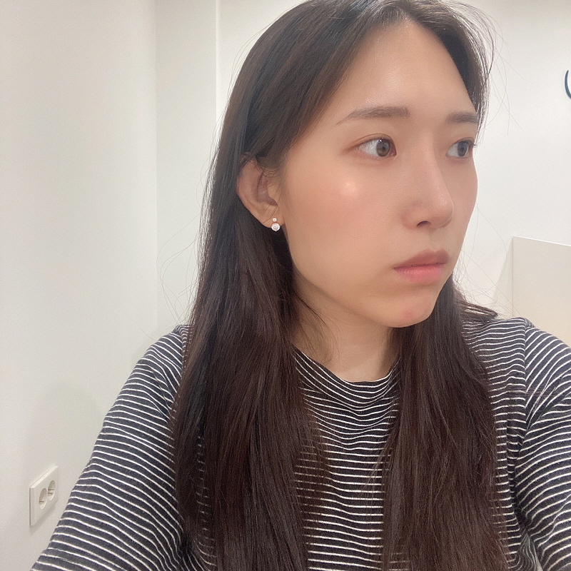 익숙해진 3개월차 후기! 제일 걱정이던 휜코 역시 잡아주고 라인까지 살려서 코끝을 높여주셔서 지금 딱 제가 원하는 이상적인 라인이에요