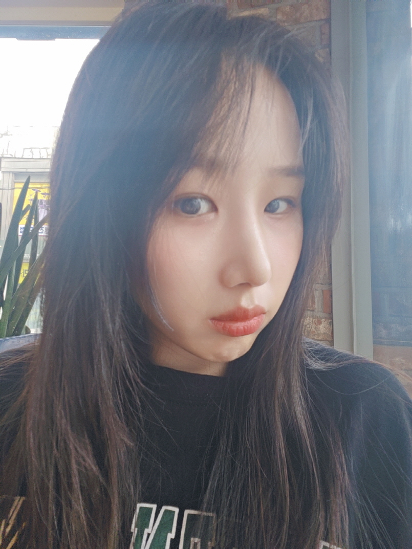 전체적으로 자연스럽게 잘 잡히고 있고 코끝 어색함도 많이 줄었어요! 주변에서도 이쁘대요 ㅎㅎ